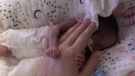 Baby Born at 22 Weeks Survives Against Odds