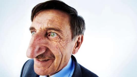 Turkish Man Has Largest Nose in the World