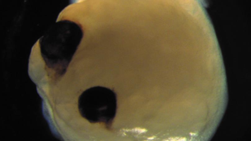 Scientists Grow Tiny ‘Lab Brains’ With ‘Eyes Sensitive to Light’