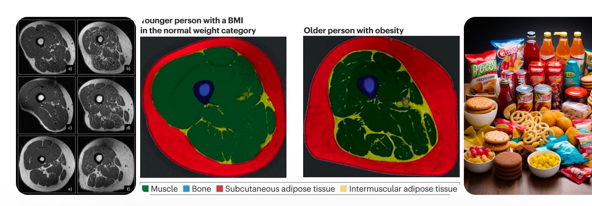 صور صادمة: هذا ما تفعله الأطعمة فائقة المعالجة بعضلاتك