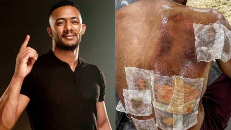 إصابة محمد رمضان خطرة والصورة تتحدّث!