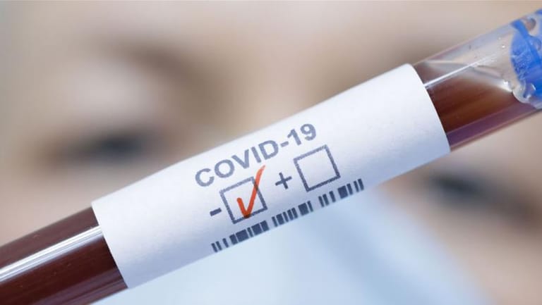 يزوّران فحوص PCR!