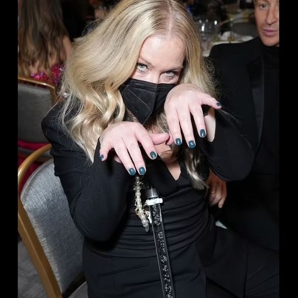 بسبب مرضها... كريستينا آبلغيت تستعين بعكازة في حفلة جوائز