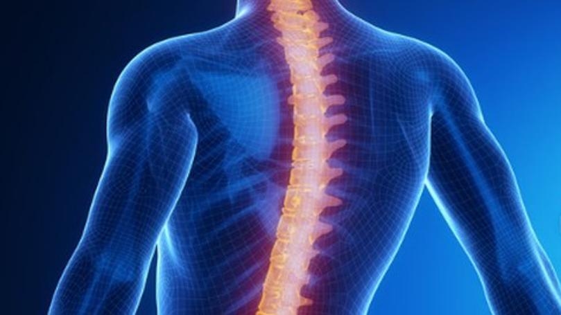 إنحناء العمود الفقري من أعراض متلازمة "لوبشتاين"