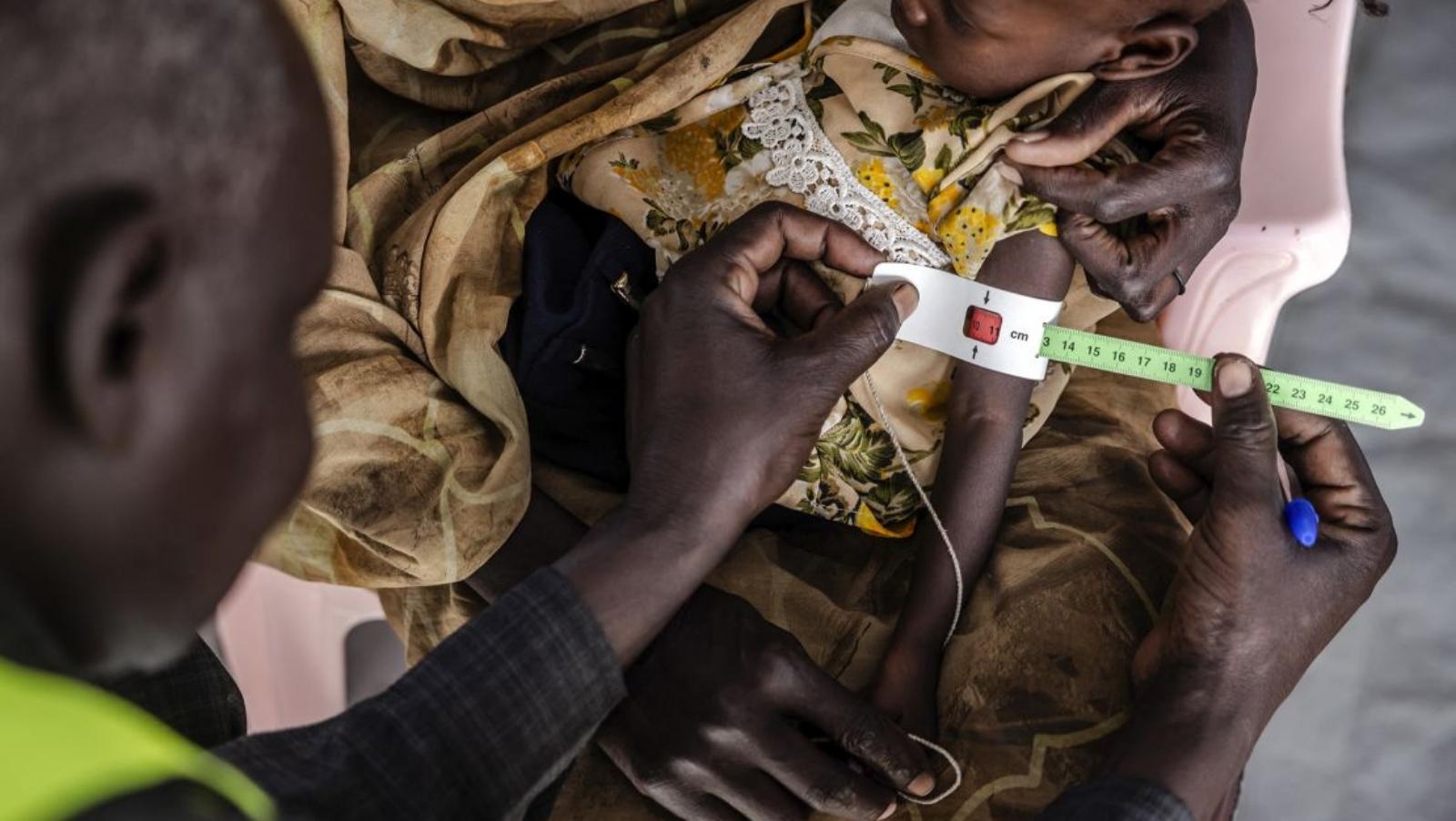 South Sudanese Children Die as US Aid Cuts Shutter Medical Services