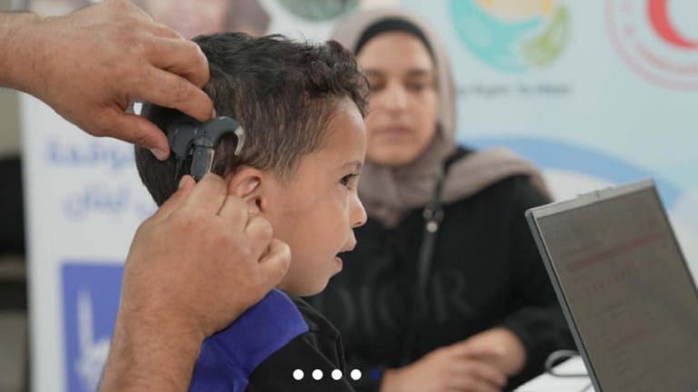 من الصمت إلى الصوت: زراعة القوقعة تبعث الأمل في قلوب الأطفال