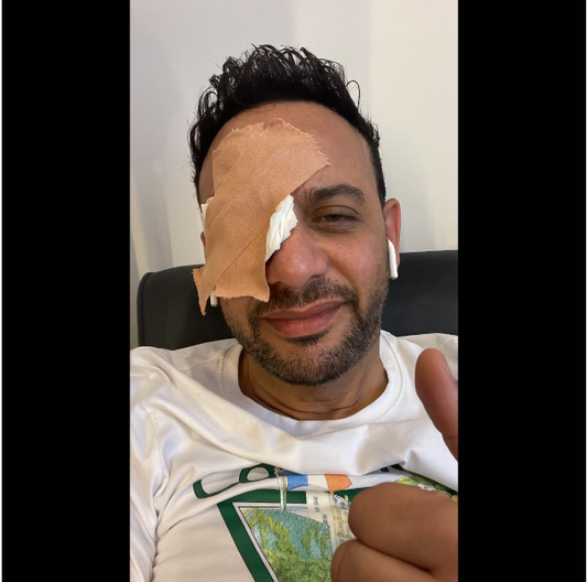 مصطفى قمر يعلن إصابته في عينه خلال تصوير فيلم "أولاد حريم كريم"