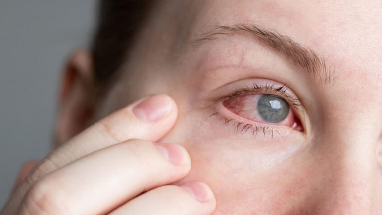 طرق بسيطة لترطيب العين