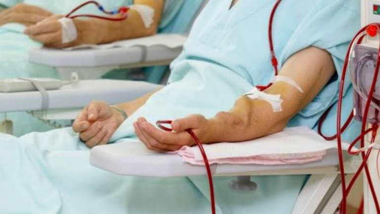 مرضى غسيل الكلى مرهونون لـ"الأنابيب"!