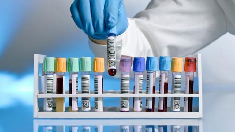 جدري القرود: الفحص يصل بعد أسبوعين؟