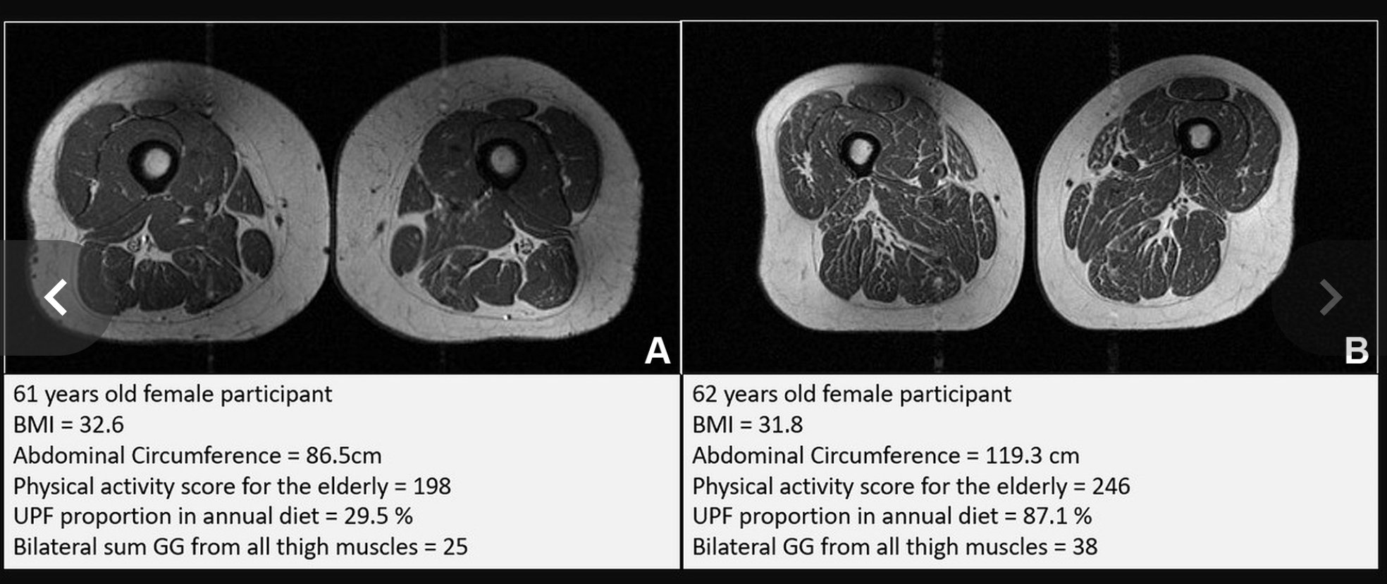 صور صادمة: هذا ما تفعله الأطعمة فائقة المعالجة بعضلاتك