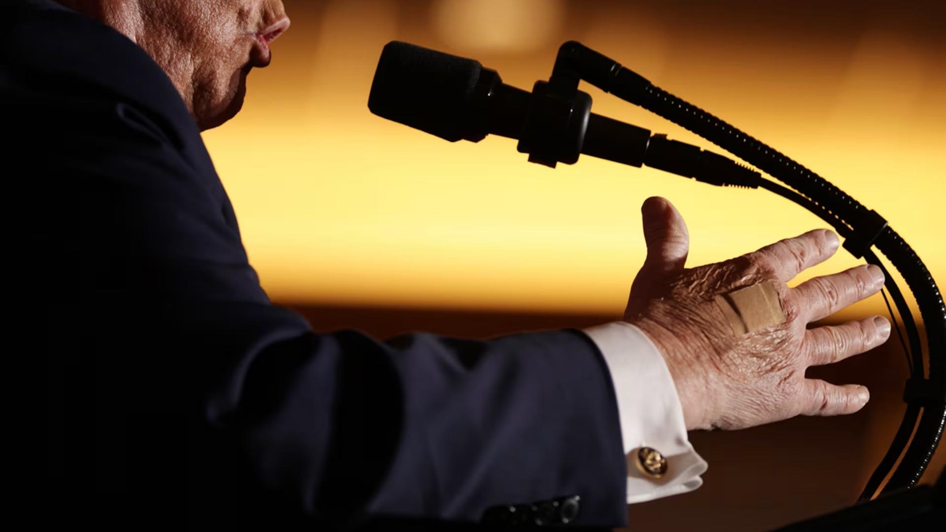 بالصّورة: ضمادة على يد ترامب.. ما السّبب؟