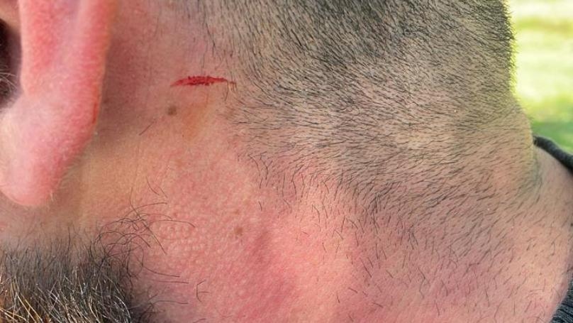 بالصّور: اعتداء على مشاركين في إعلان لائحة "معاً للتغيير" ومحاصرتهم