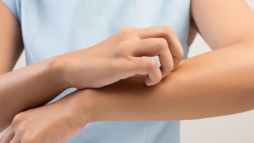 الحكة المستمرة قد تكون علامة على مرض مزمن