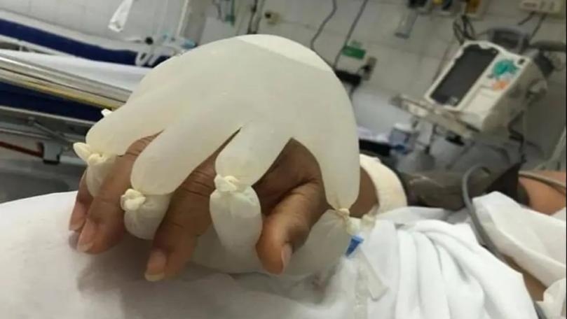 Nurse Creates Warm Glove ‘Hands’ for Covid Patient to Hold in Isolation Ward