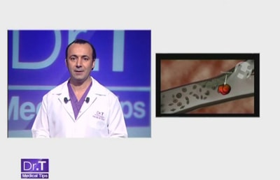 Aspirin