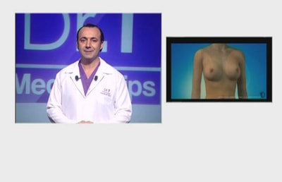 Breast Augmentation