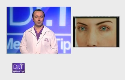 Conjunctivitis