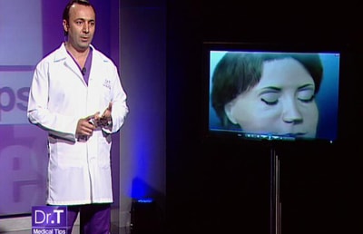Blepharoplasty - 10 Jun 2013