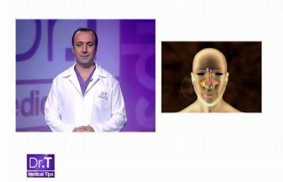 Sinusitis - 13 Jun 2013