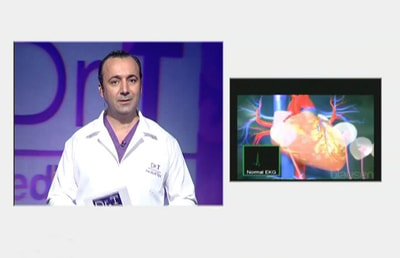 Tachycardia