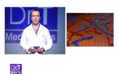 Liver Cirrhosis - 26 Jul 2013