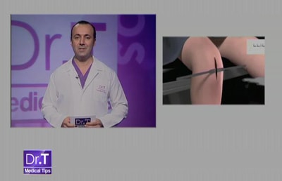 Leg Lengthening - 02 Aug 2013