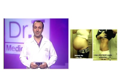 Losing weight after pregnancy