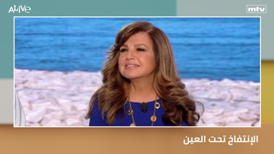 Puffiness under the eyes